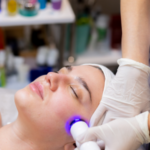 Laser toning for skin in kochi