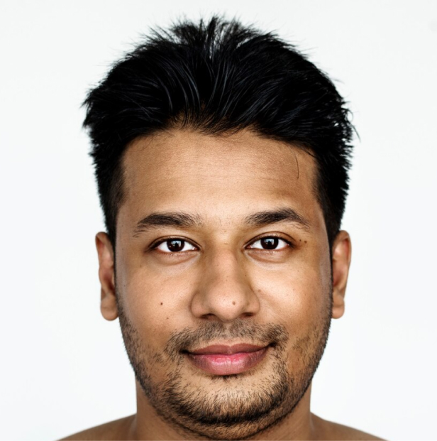 pigmentation after peel