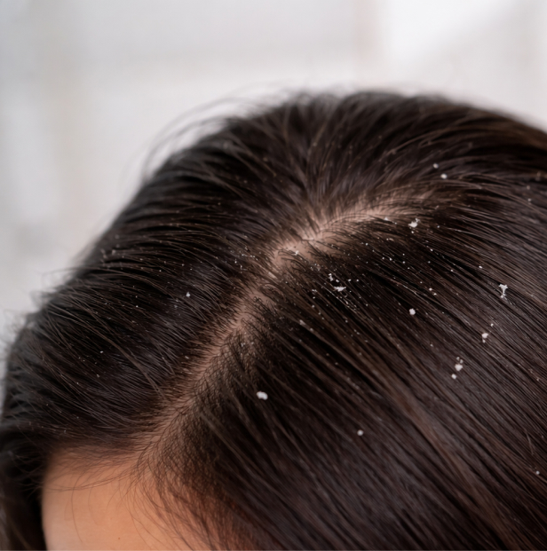 scalp treatment before