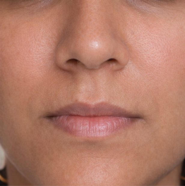 skin allergy treatment kochi after