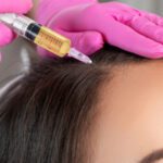 GFC for hair loss