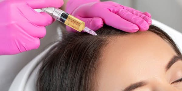 GFC for hair loss