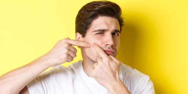 acne scars removal treatment