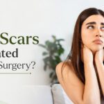 Remove acne marks without surgery