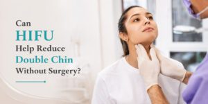 HIFU for Double Chin: Can It Improve Jawline Definition?