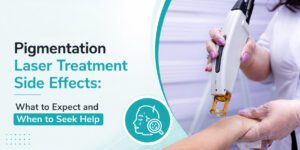 laser treatment and pigmentation