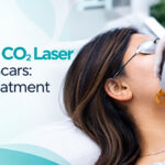 MNRF CO2 laser