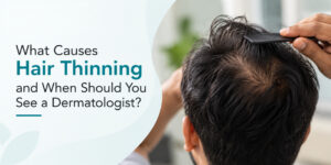 What Causes Hair Thinning and When Should You See a Dermatologist?