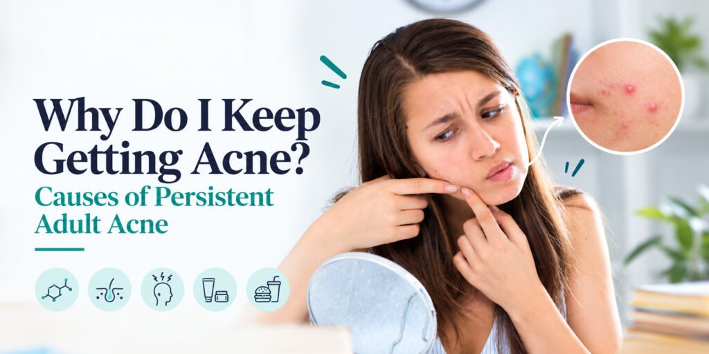 Why Do I Keep Getting Acne? Causes of Persistent Adult Acne 1 Acne Breakouts